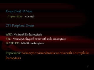 X-ray Chest PA View
Impression : normal
CPB Peripheral Smear
WBC : Neutrophillic leucocytosis
RBC : Normocytic hypochromic with mild anisocytosis
PLATELETS : Mild thrombocytosis
Impression: normocytic normochromic anemia with neutrophillic
leucocytosis
14
 