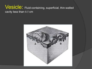 Vesicle With Ruler 1. Basic structures and functions of skin | PPTX