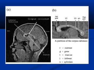 Radiological anatomy of the brain | PPT