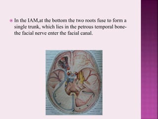  In the IAM,at the bottom the two roots fuse to form a
single trunk, which lies in the petrous temporal bone-
the facial nerve enter the facial canal.
 