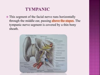  This segment of the facial nerve runs horizontally
through the middle ear, passing above the stapes. The
tympanic nerve segment is covered by a thin bony
sheath.
 
