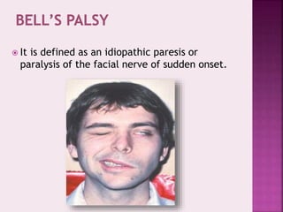  It is defined as an idiopathic paresis or
paralysis of the facial nerve of sudden onset.
 