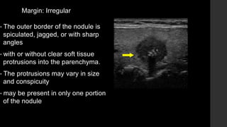 Margin: Irregular
• The outer border of the nodule is
spiculated, jagged, or with sharp
angles
• with or without clear soft tissue
protrusions into the parenchyma.
• The protrusions may vary in size
and conspicuity
• may be present in only one portion
of the nodule
 