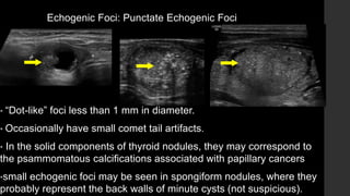 Echogenic Foci: Punctate Echogenic Foci
• “Dot-like” foci less than 1 mm in diameter.
• Occasionally have small comet tail artifacts.
• In the solid components of thyroid nodules, they may correspond to
the psammomatous calcifications associated with papillary cancers
•small echogenic foci may be seen in spongiform nodules, where they
probably represent the back walls of minute cysts (not suspicious).
 