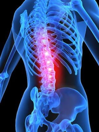 There was a recent post in this Dr. Joseph Yazdi blog about spinal compression fracture. Check it out.b