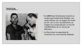 1. historia de la endoscopia | PPTX