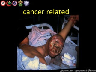 cancer related
 