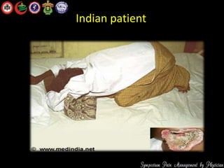 Indian patient
 