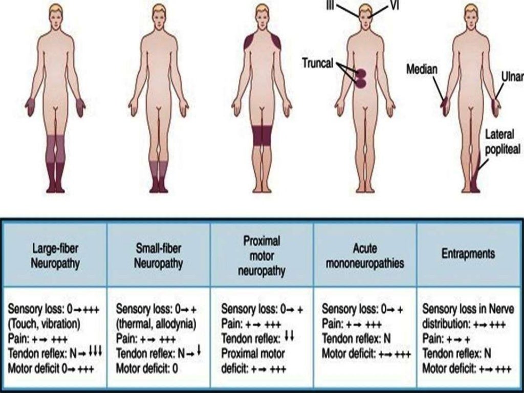 1. diabetic neuropathy