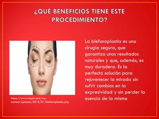 La blefaroplastia es una
cirugía segura, que
garantiza unos resultados
naturales y que, además, es
muy duradera. Es la
perfecta solución para
rejuvenecer la mirada sin
sufrir cambios en la
expresividad y sin perder la
esencia de la mismahttps://www.vissum.com/wp-
content/uploads/2018/01/blefaroplastia.png
 
