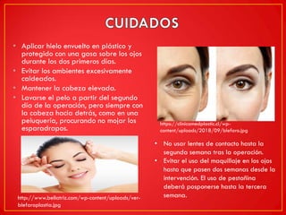 • Aplicar hielo envuelto en plástico y
protegido con una gasa sobre los ojos
durante los dos primeros días.
• Evitar los ambientes excesivamente
caldeados.
• Mantener la cabeza elevada.
• Lavarse el pelo a partir del segundo
día de la operación, pero siempre con
la cabeza hacia detrás, como en una
peluquería, procurando no mojar los
esparadrapos.
• No usar lentes de contacto hasta la
segunda semana tras la operación.
• Evitar el uso del maquillaje en los ojos
hasta que pasen dos semanas desde la
intervención. El uso de pestañina
deberá posponerse hasta la tercera
semana.http://www.bellatriz.com/wp-content/uploads/ver-
blefaroplastia.jpg
https://clinicamedplastic.cl/wp-
content/uploads/2018/09/blefaro.jpg
 