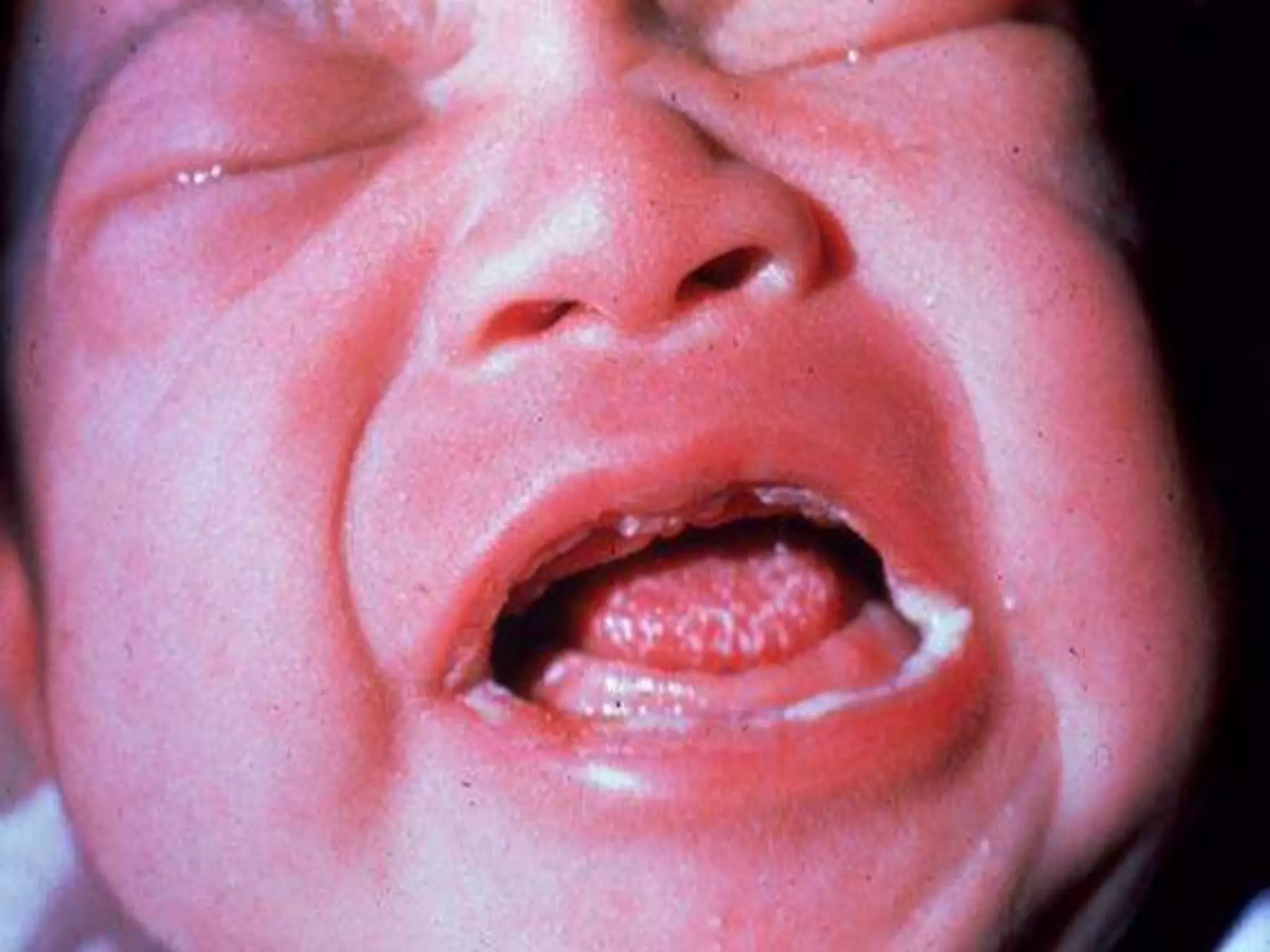 Lesions of oral cavity and salivary gland. | PPTX