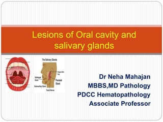 Dr Neha Mahajan
MBBS,MD Pathology
PDCC Hematopathology
Associate Professor
Lesions of Oral cavity and
salivary glands
 