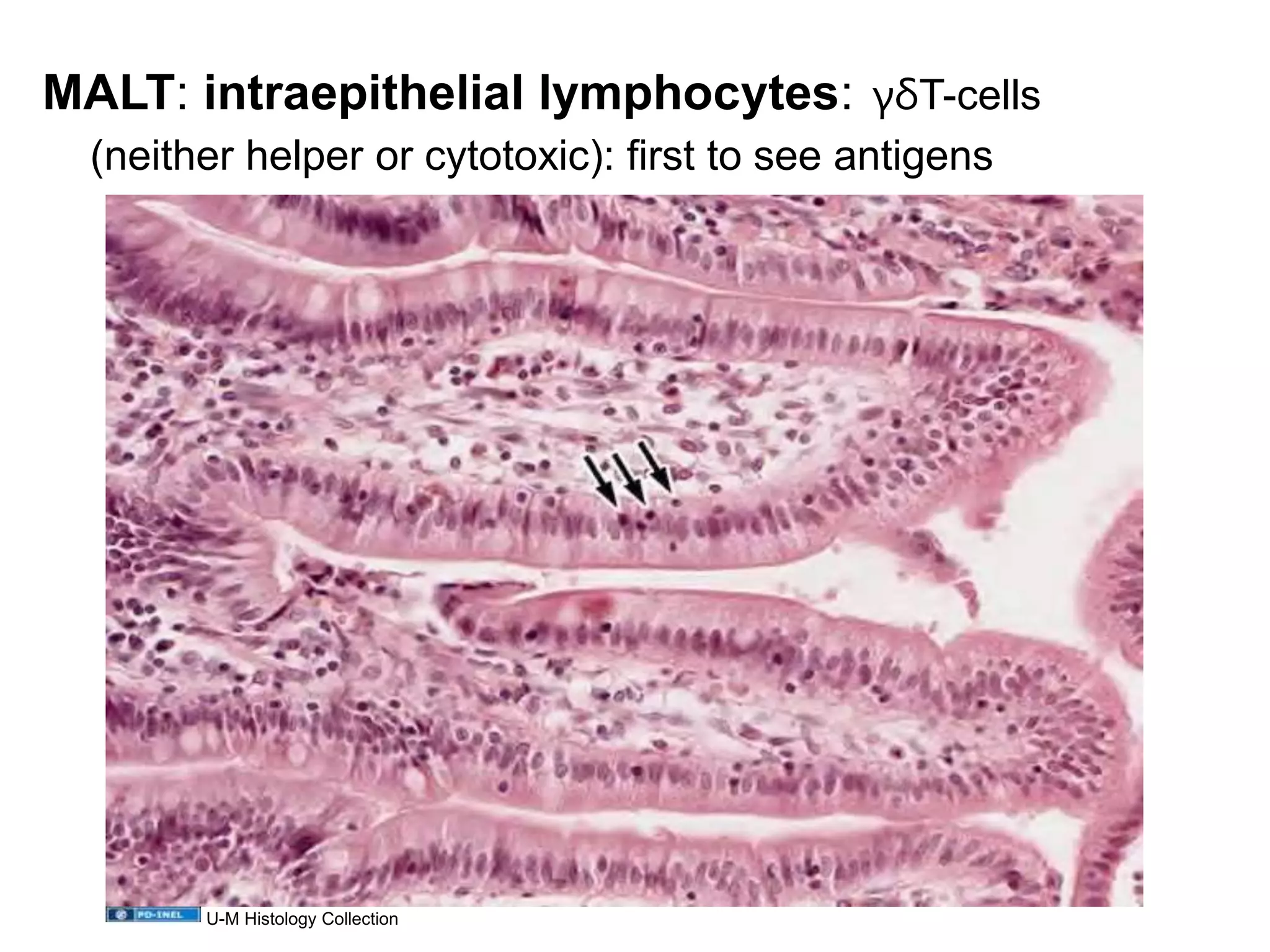 MALT: intraepithelial lymphocytes: γδT-cells
(neither helper or cytotoxic): first to see antigens
U-M Histology Collection
 