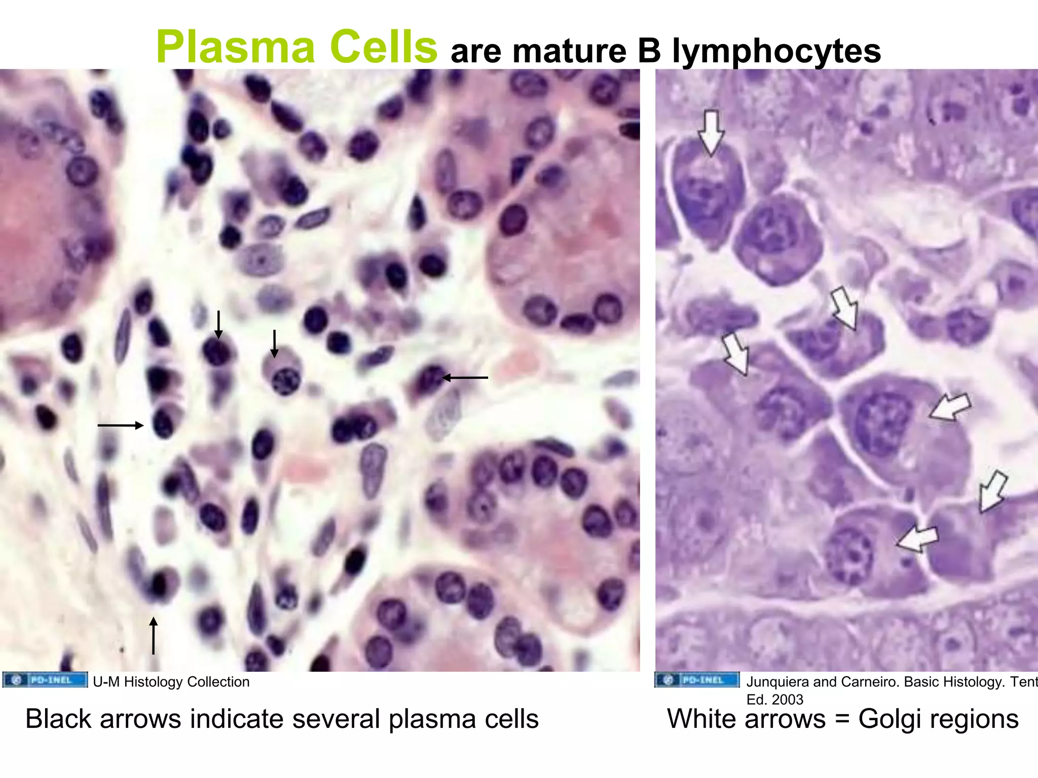 White arrows = Golgi regionsBlack arrows indicate several plasma cells
U-M Histology Collection Junquiera and Carneiro. Basic Histology. Tent
Ed. 2003
Plasma Cells are mature B lymphocytes
 