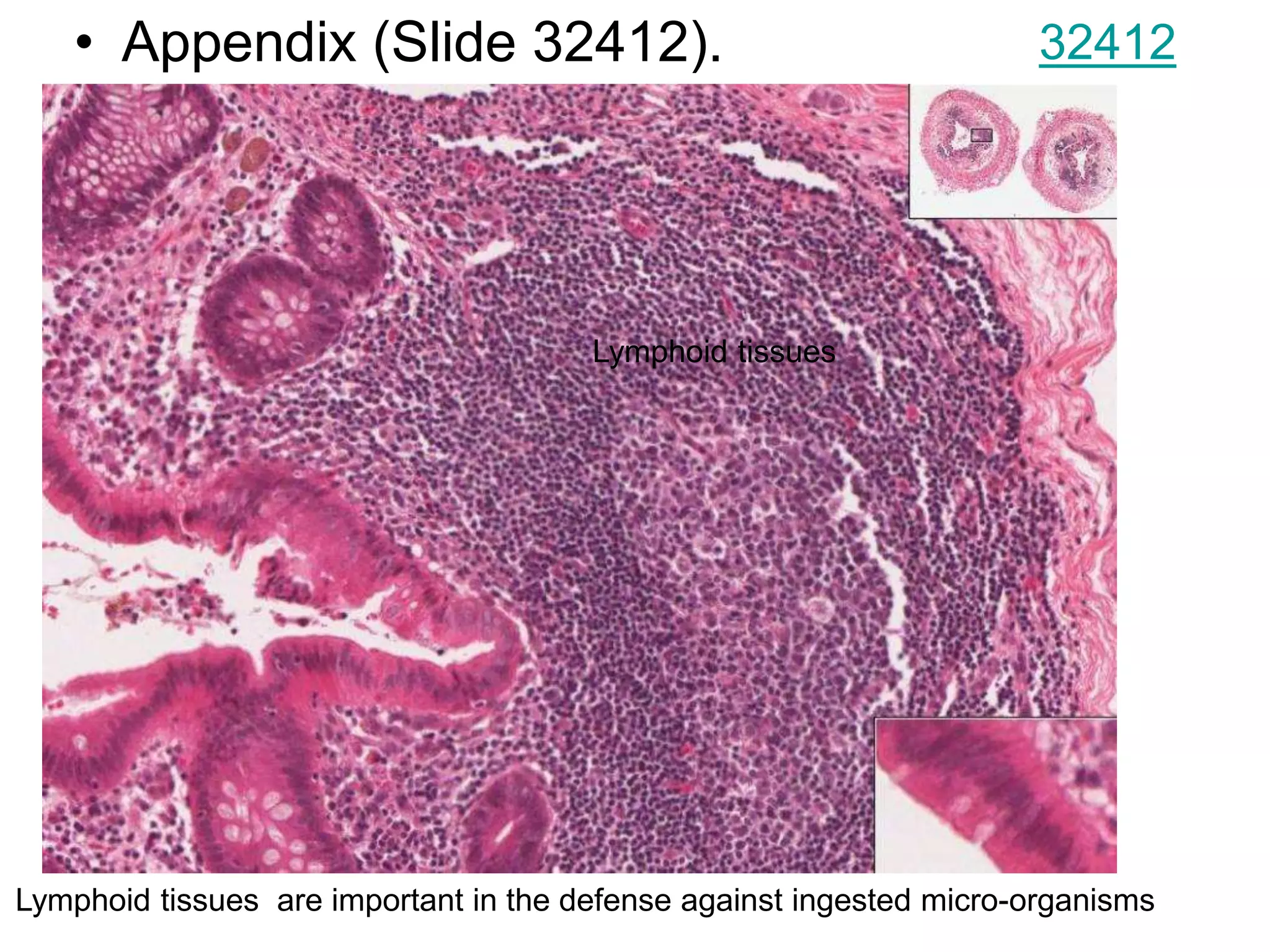 • Appendix (Slide 32412). 32412
Lymphoid tissues are important in the defense against ingested micro-organisms
Lymphoid tissues
 