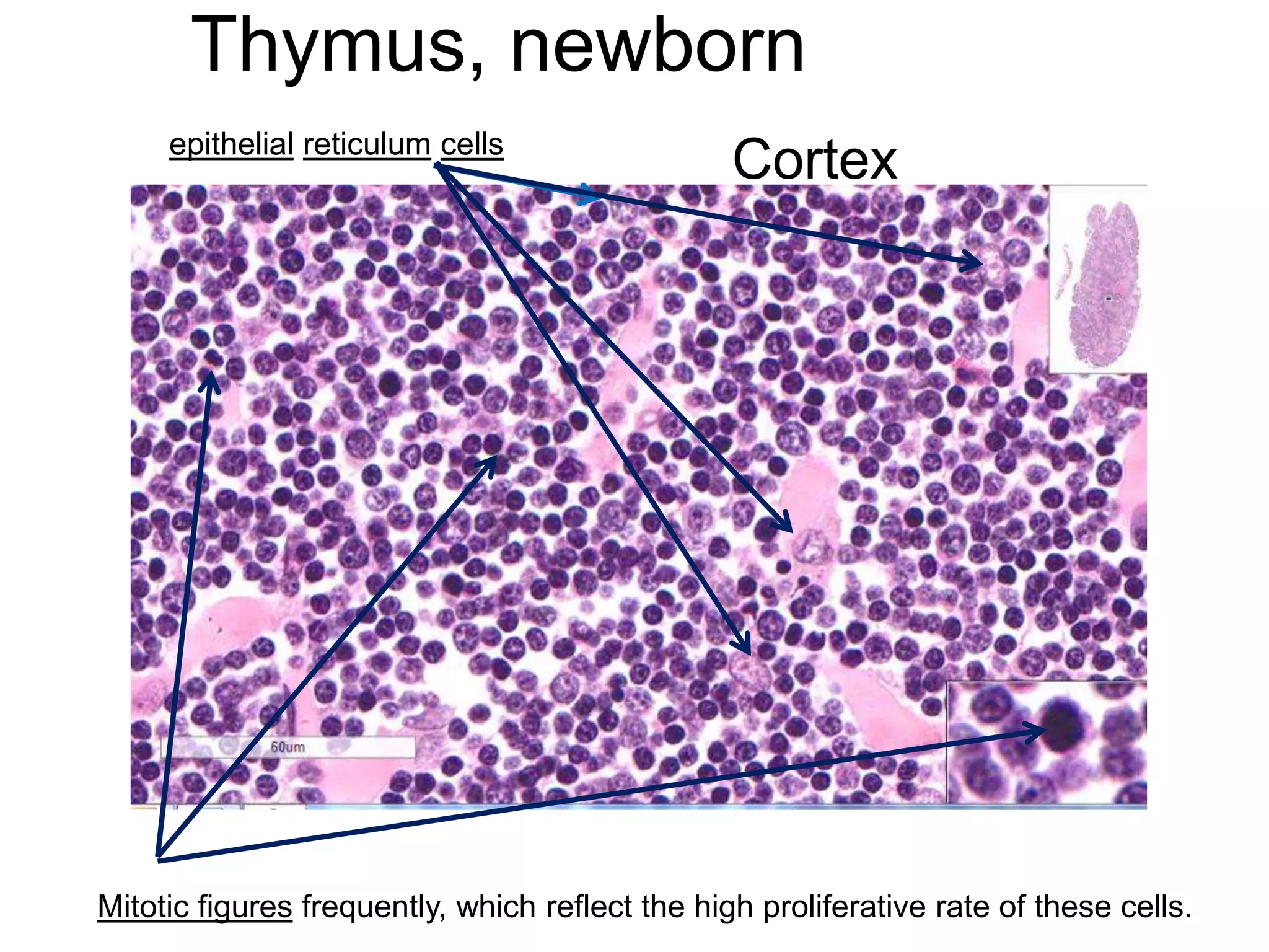 Thymus, newborn
Cortex
Mitotic figures frequently, which reflect the high proliferative rate of these cells.
epithelial reticulum cells
 