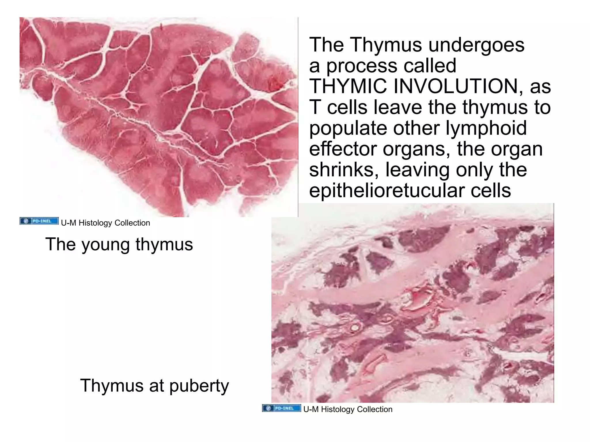 The Thymus undergoes
a process called
THYMIC INVOLUTION, as
T cells leave the thymus to
populate other lymphoid
effector organs, the organ
shrinks, leaving only the
epithelioretucular cells
The young thymus
Thymus at puberty
U-M Histology Collection
U-M Histology Collection
 