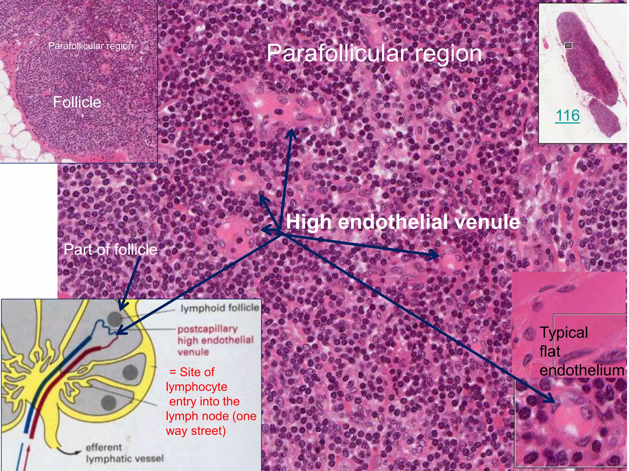 Parafollicular regionParafollicular region
High endothelial venule
Part of follicle
Follicle
Typical
flat
endothelium= Site of
lymphocyte
entry into the
lymph node (one
way street)
116
 