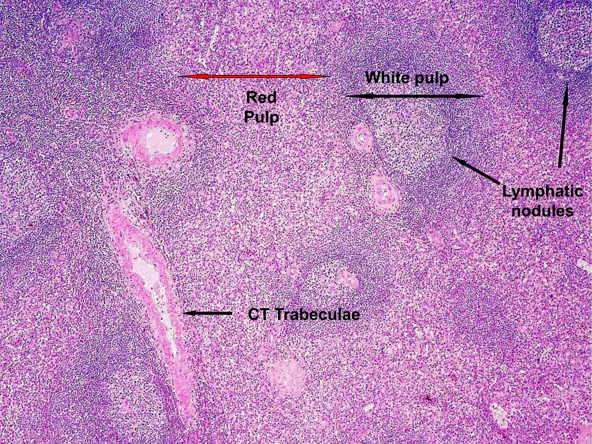 CT Trabeculae
Lymphatic
nodules
White pulp
Red
Pulp
 