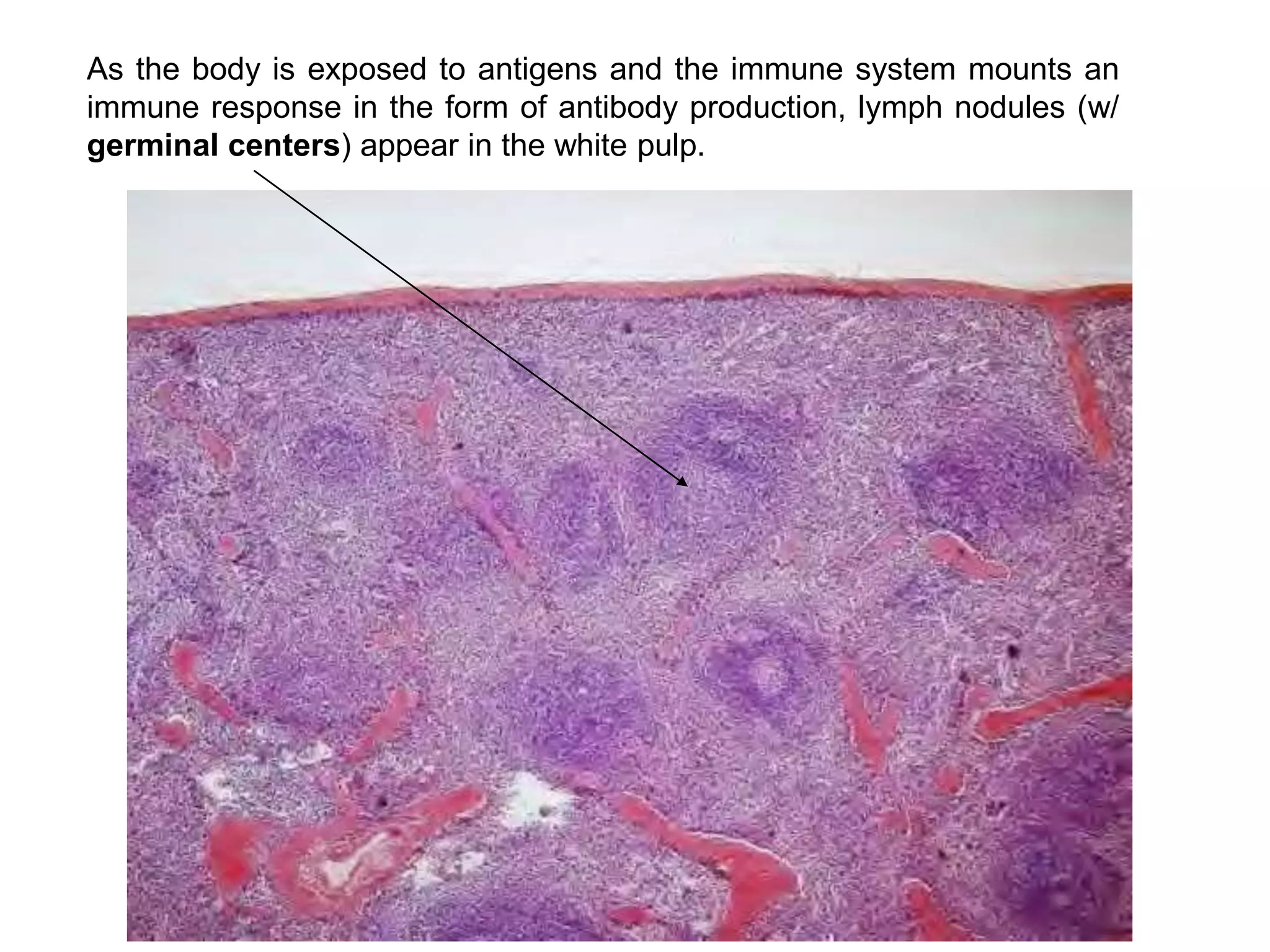As the body is exposed to antigens and the immune system mounts an
immune response in the form of antibody production, lymph nodules (w/
germinal centers) appear in the white pulp.
 