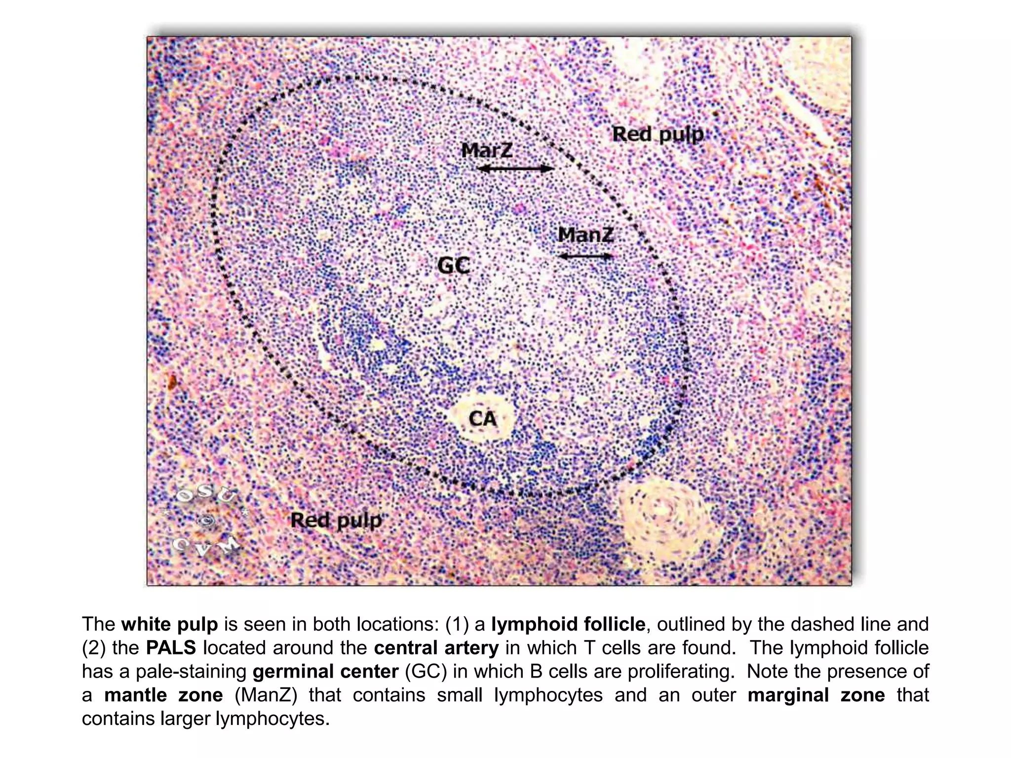 The white pulp is seen in both locations: (1) a lymphoid follicle, outlined by the dashed line and
(2) the PALS located around the central artery in which T cells are found. The lymphoid follicle
has a pale-staining germinal center (GC) in which B cells are proliferating. Note the presence of
a mantle zone (ManZ) that contains small lymphocytes and an outer marginal zone that
contains larger lymphocytes.
 
