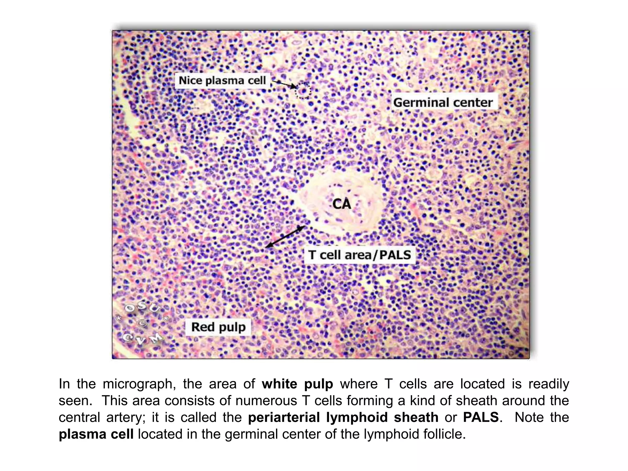 In the micrograph, the area of white pulp where T cells are located is readily
seen. This area consists of numerous T cells forming a kind of sheath around the
central artery; it is called the periarterial lymphoid sheath or PALS. Note the
plasma cell located in the germinal center of the lymphoid follicle.
 