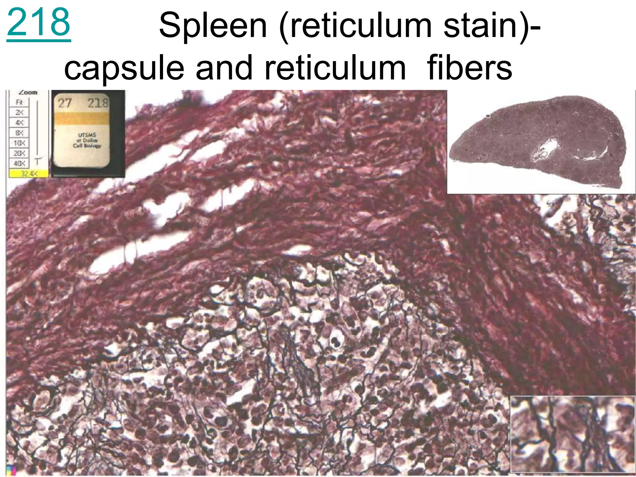 Spleen (reticulum stain)-
capsule and reticulum fibers
218
 