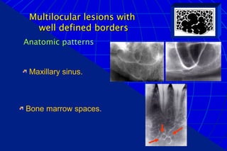 Diffuse Borders Oral radiology intro differential diagnosis | PPT