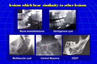 Oral radiology intro differential diagnosis | PPT