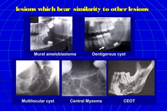 Oral radiology intro differential diagnosis | PPT | Dental Health ...