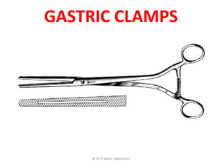 @ Dr.Prabhat Vaghamshi
GASTRIC CLAMPS
 