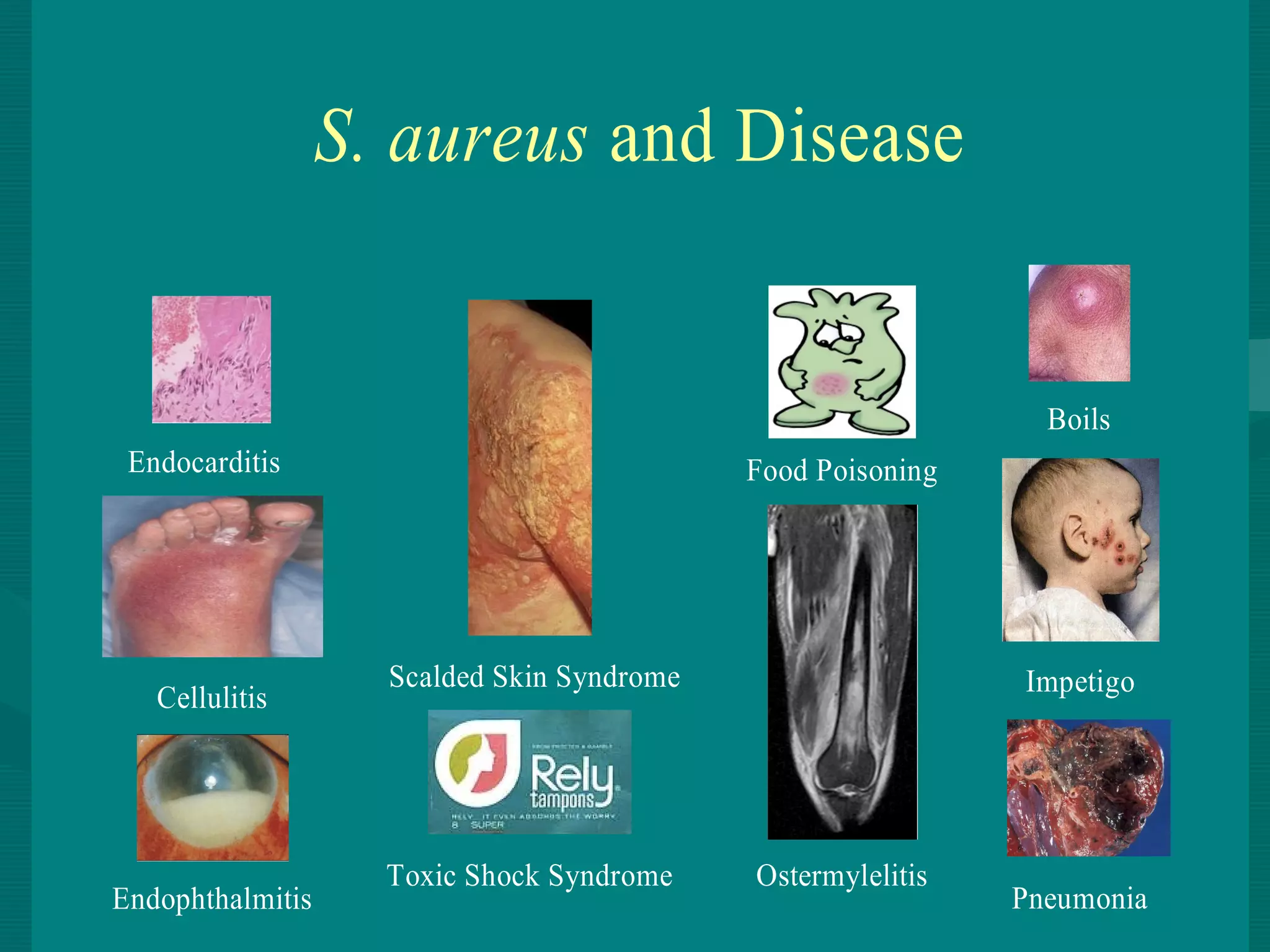 Staphylococcus aureus | PPT