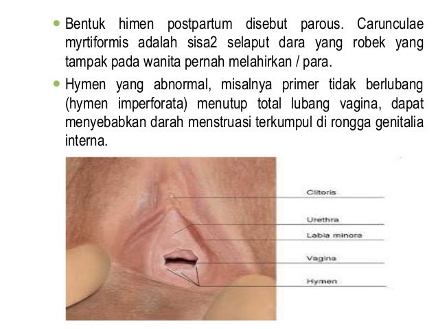 Ciri Ciri Perempuan Tak Perawan Nomor 2 Sangat Mudah Diketahui Halaman 3 Tribun Timur Com
