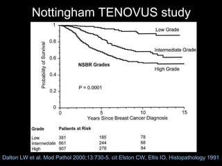 Nottingham TENOVUS study Dalton LW et al. Mod Pathol 2000;13:730-5. cit Elston CW, Ellis IO. Histopathology 1991 
