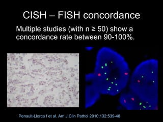 CISH – FISH concordance Multiple studies (with n  ≥ 50)  show a concordance rate between 90-100%. Penault-Llorca f et al. Am J Clin Pathol 2010;132:539-48 