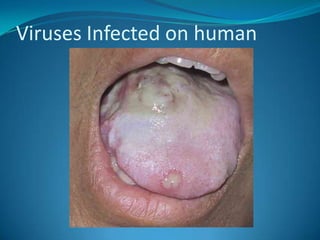 Viruses Infected on human