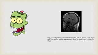 1 1 introduction-to_the_focused_and_diffuse_mode | PPTX
