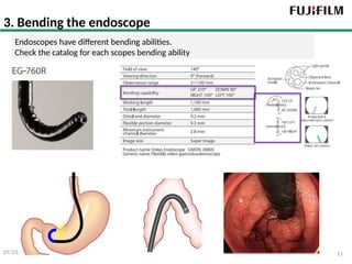 Basic Endoscope Operations in Flexible Endoscopes | PPTX
