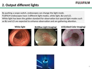 Basic Endoscope Operations in Flexible Endoscopes | PPTX