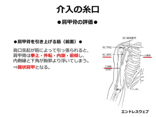 ●肩甲骨を引き上げる筋（前面）●
烏口突起が筋によって引っ張られると、
肩甲骨は拳上・外転・内旋・前傾し、
内側縁と下角が胸郭より浮いてしまう。
⇒翼状肩甲となる。
エンドレスウェブ
介入の糸口
●肩甲骨の評価●
 