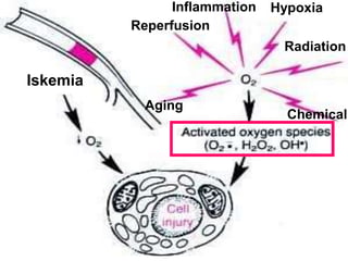 Iskemia
Inflammation Hypoxia
Chemical
Reperfusion
Radiation
Aging
 