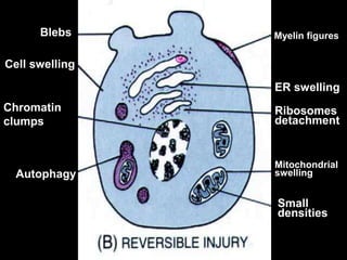Myelin figures
ER swelling
Ribosomes
detachment
Mitochondrial
swelling
Small
densities
Blebs
Cell swelling
Chromatin
clumps
Autophagy
 