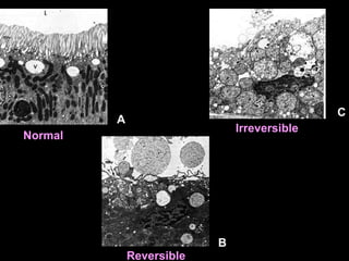 A
B
C
Reversible
Irreversible
Normal
 