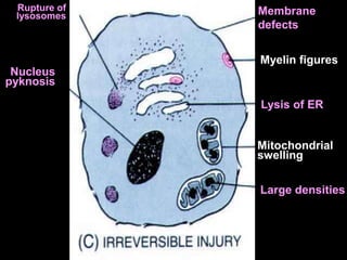 Membrane
defects
Myelin figures
Lysis of ER
Mitochondrial
swelling
Large densities
Nucleus
pyknosis
Rupture of
lysosomes
 