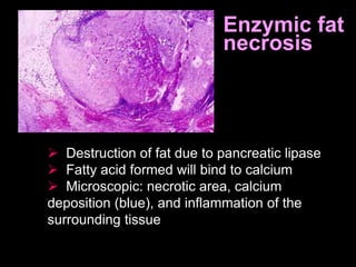 Enzymic fat
necrosis
 Destruction of fat due to pancreatic lipase
 Fatty acid formed will bind to calcium
 Microscopic: necrotic area, calcium
deposition (blue), and inflammation of the
surrounding tissue
 