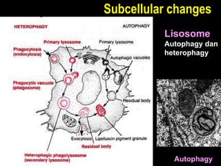 Subcellular changes
Autophagy
Lisosome
Autophagy dan
heterophagy
 