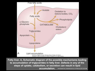 Fatty liver. A, Schematic diagram of the possible mechanisms leading
to accumulation of triglycerides in fatty liver. Defects in any of the
steps of uptake, catabolism, or secretion can result in lipid
accumulation. Downloaded from: StudentConsult (on 19 February 2012 10:23 PM)
 