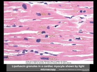 Lipofuscin granules in a cardiac myocyte shown by light
microscopy Downloaded from: StudentConsult (on 19 February 2012 10:23 PM)
© 2005 Elsevier
 