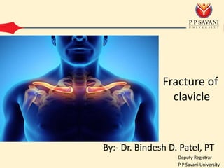 Fracture of
clavicle
By:- Dr. Bindesh D. Patel, PT
Deputy Registrar
P P Savani University
 